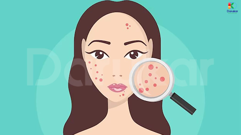 تغییرات در رژیم غذایی برای درمان چربی پوست صورت